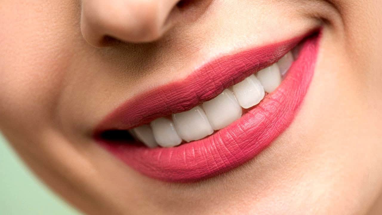 smile-solutions-dental-practise-pretoria-single-visit-restorations-003