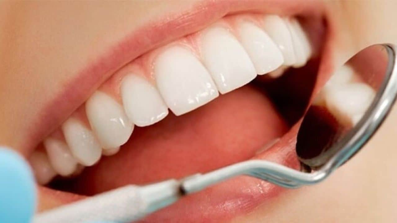 smile-solutions-dental-practise-pretoria-single-visit-restorations