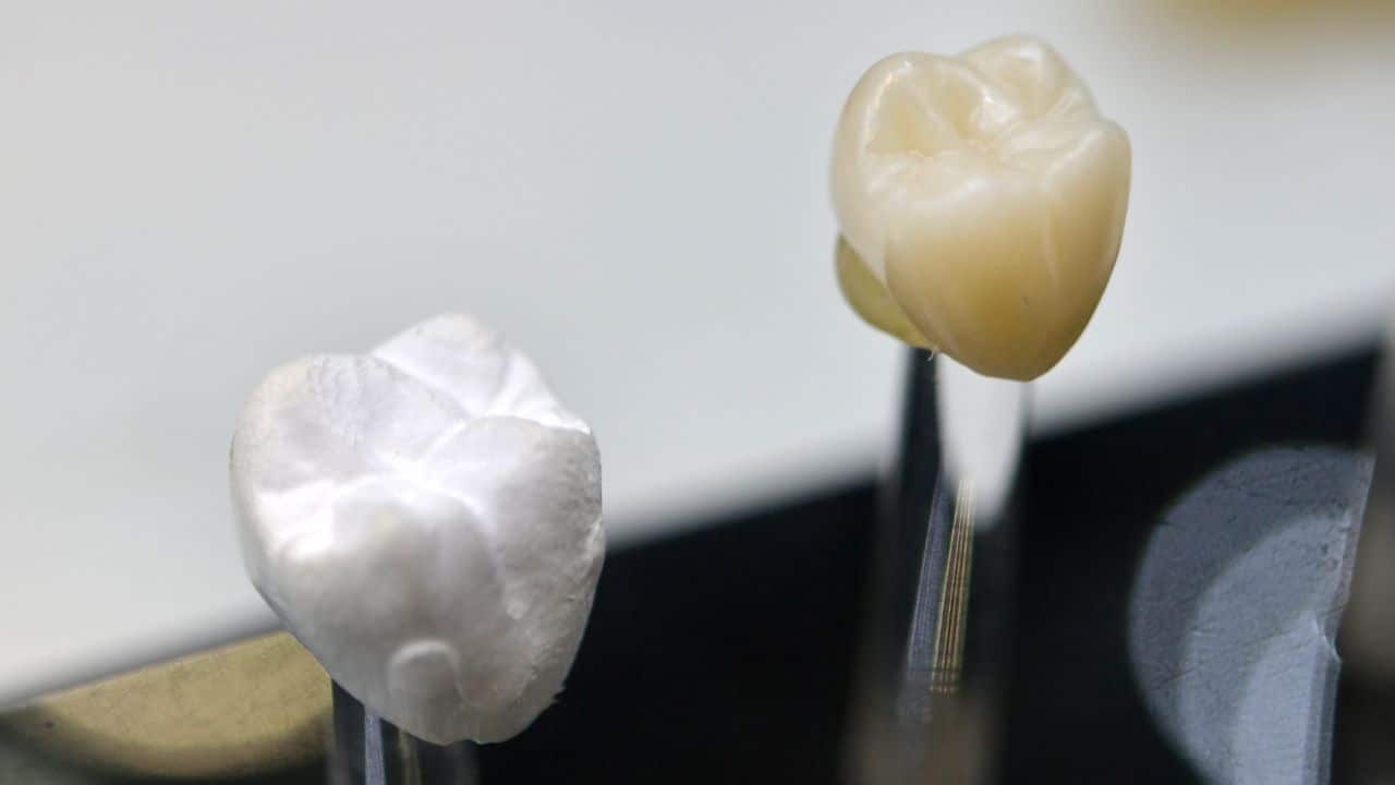 smile-solutions-dental-practise-restorative-treatments-banner