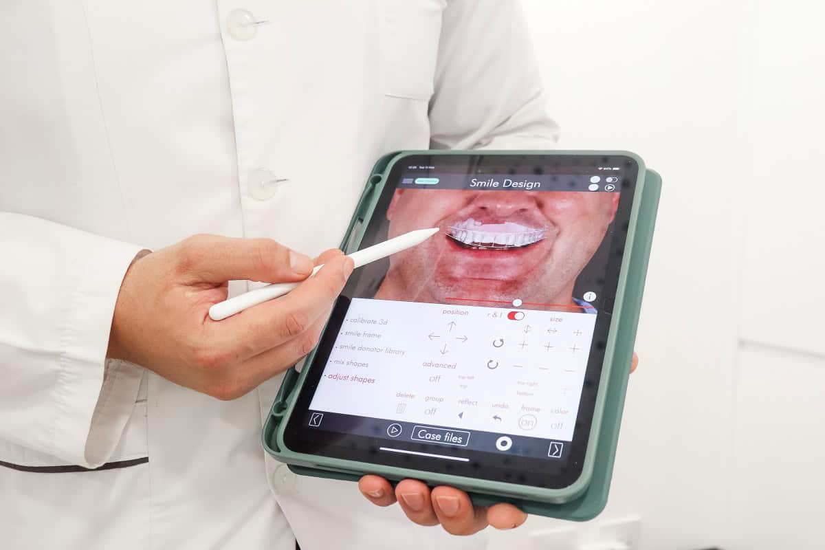 smile-solutions-dental-practise-digital-smile-design