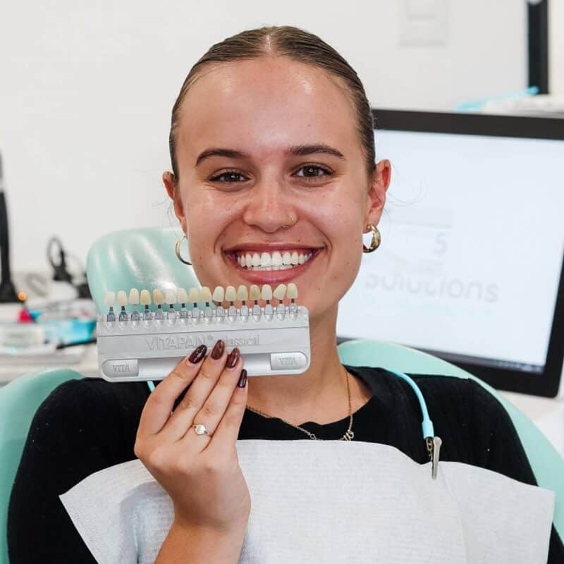 smile-solutions-dental-practise-pretoria-teeth-Whitening