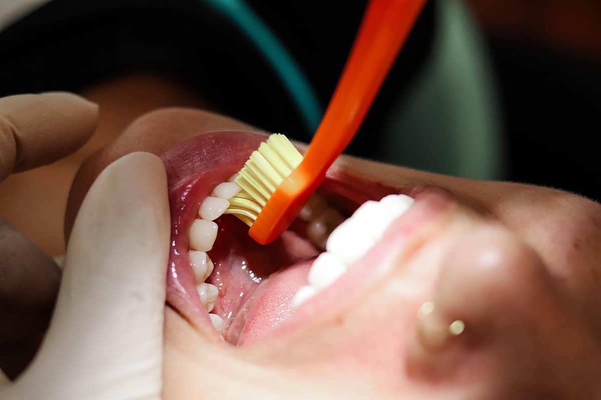smile-solutions-dental-pretoria-teeth-cleaning-01